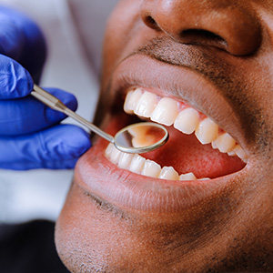 Best Dentist in Zionville